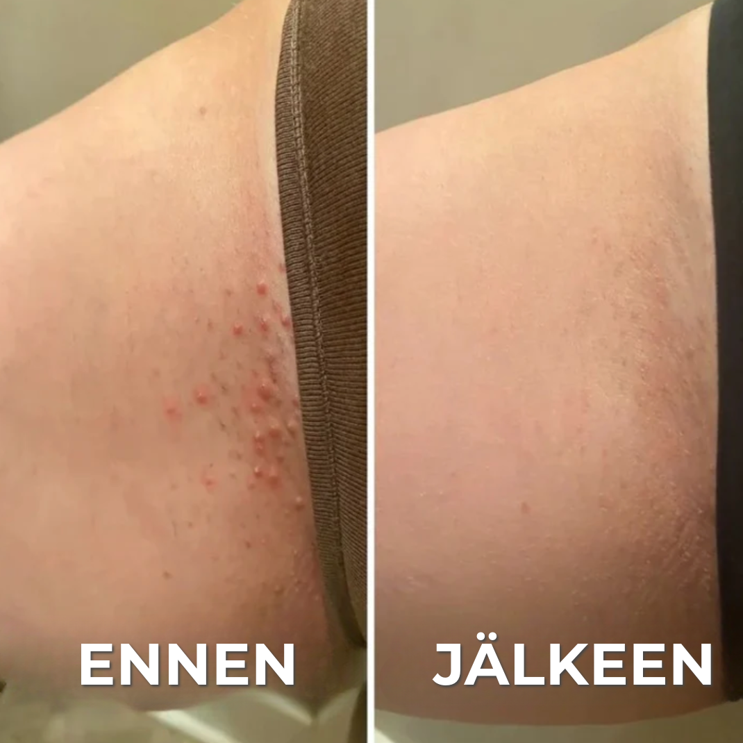 Ammattimainen ihoystävällinen trimmeri