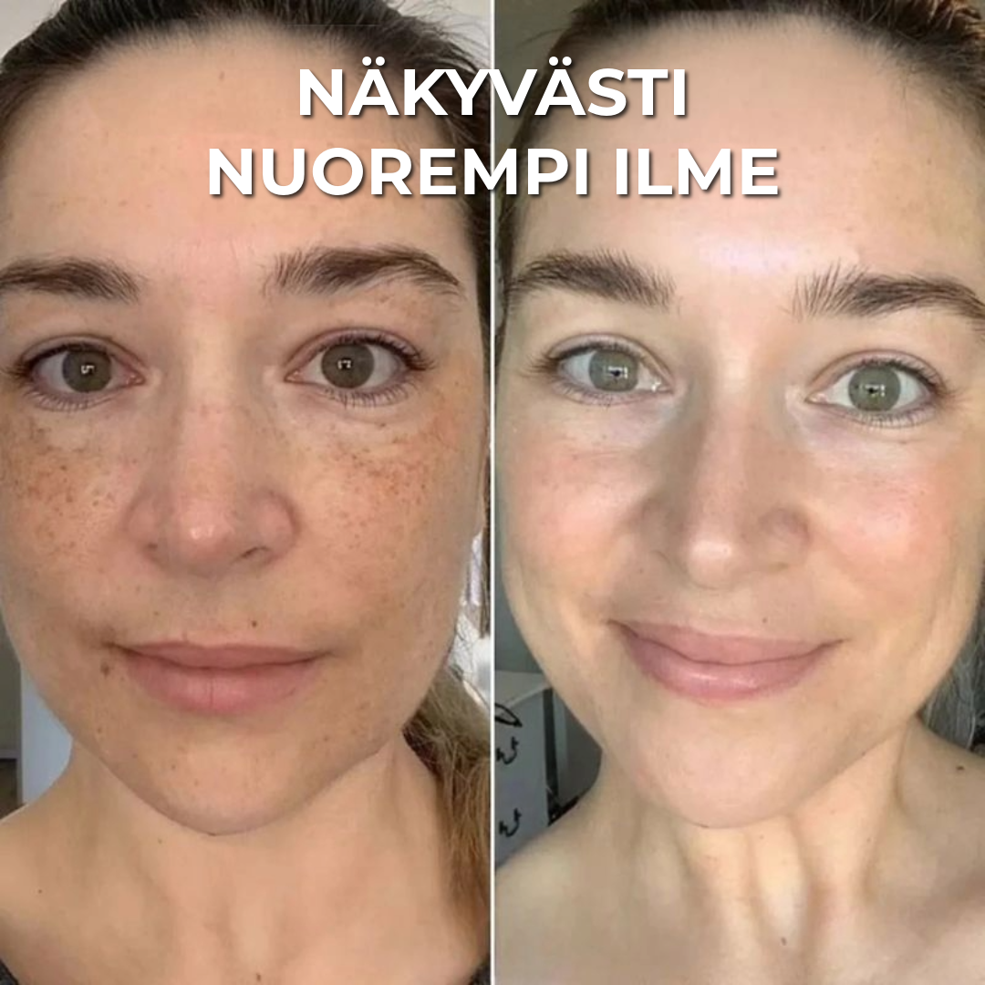 Lumeor™ Kollageeninaamio