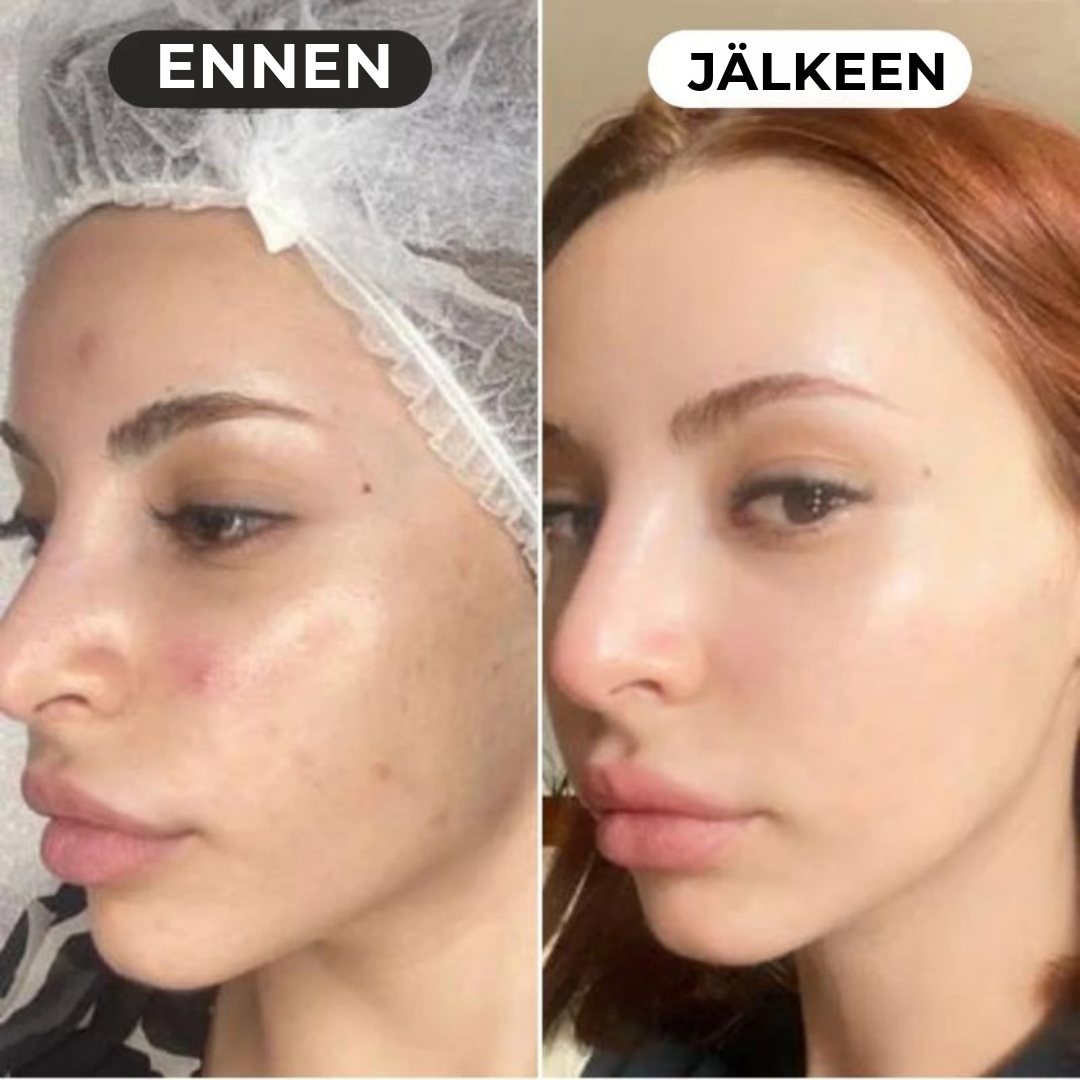 Lumeor™ Kollageeninaamio