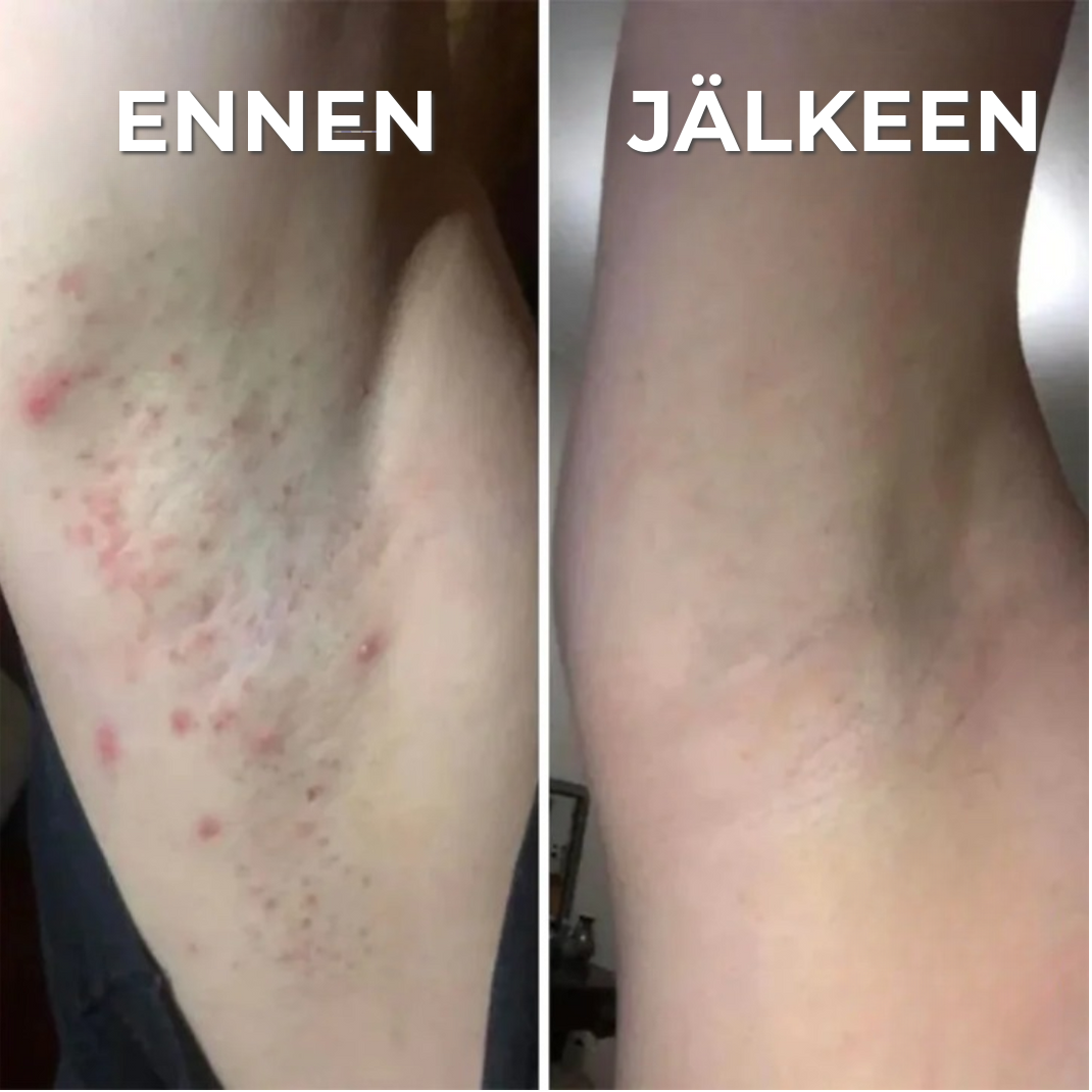 Ammattimainen ihoystävällinen trimmeri