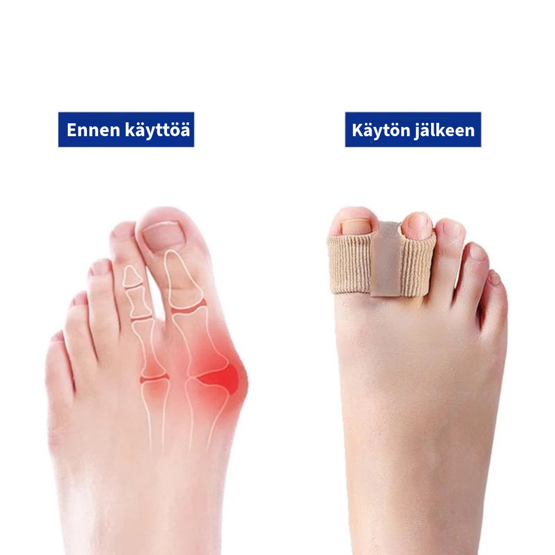 Joustavat Varpaiden Erottelijat